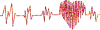 electrocardiogram-2858693_1280